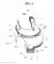 Fig. 02 - Cleaning robot