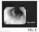 Fig. 06 - Endoscope system and evaluation value calculation device