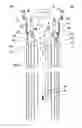 Fig. 03 - Advanced 3-dimensional endoscopic system with real dynamic convergence
