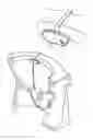 Fig. 01 - Device and method for the mobile analysis of excrement in a toilet