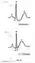 Fig. 49 - Automated ECG analysis and diagnosis system