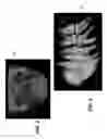 Fig. 04 - Method for cephalometric analysis