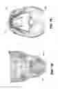 Fig. 07 - Method for cephalometric analysis