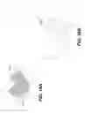 Fig. 24 - Method for cephalometric analysis