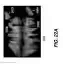 Fig. 28 - Method for cephalometric analysis