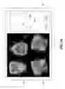 Fig. 44 - Method for cephalometric analysis