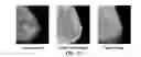 Fig. 10 - Method and device for diagnosis of breast disease