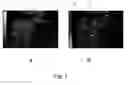 Fig. 07 - Time-based parametric contrast enhanced ultrasound imaging system and method