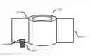 Fig. 01 - Rectum gas passage analyzer