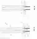 Fig. 02 - Device for carrying out a distraction for a compression of vertebral bodies during a spinal surgery