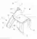 Fig. 01 - Cardiac surgery retractor