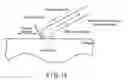Fig. 16 - Surgical system