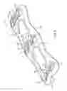 Fig. 06 - Anterior cervical plate