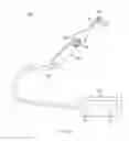 Fig. 45 - Pressure sensitive tissue treatment device
