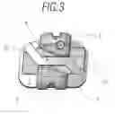 Fig. 04 - PERFECTED ORTHODONTIC ATTACHMENT