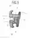 Fig. 06 - PERFECTED ORTHODONTIC ATTACHMENT