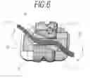 Fig. 07 - PERFECTED ORTHODONTIC ATTACHMENT