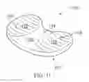 Fig. 09 - PROSTHESIS FOR SIMULATING NATURAL KINEMATICS