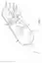 Fig. 02 - Suspensory graft fixation with adjustable loop length