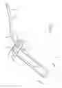 Fig. 03 - Suspensory graft fixation with adjustable loop length