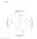 Fig. 03 - Intraocularly-mounted object and intraocularly-mounted object holding member