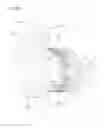 Fig. 07 - Intraocularly-mounted object and intraocularly-mounted object holding member