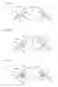Fig. 12 - Intraocularly-mounted object and intraocularly-mounted object holding member