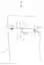 Fig. 08 - METHOD AND APPARATUS FOR PREPARATION OF AN INTRAOCULAR LENS FOR SUBSEQUENT INSERTION INTO THE EYE OF A PATIENT