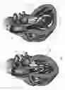 Fig. 02 - Expandable device for capturing regurgitant jet, volume, and force to effect ventricular function and remodeling