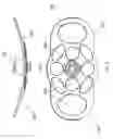 Fig. 06 - Expandable device for capturing regurgitant jet, volume, and force to effect ventricular function and remodeling