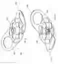 Fig. 07 - Expandable device for capturing regurgitant jet, volume, and force to effect ventricular function and remodeling