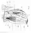 Fig. 08 - Expandable device for capturing regurgitant jet, volume, and force to effect ventricular function and remodeling