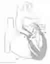 Fig. 01 - Lifetime regenerative heart valve