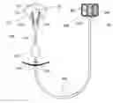 Fig. 01 - Inflatable device for improving physiological cardiac flow