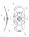 Fig. 07 - Inflatable device for improving physiological cardiac flow