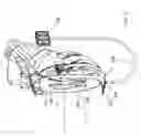 Fig. 10 - Inflatable device for improving physiological cardiac flow