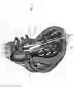 Fig. 14 - Inflatable device for improving physiological cardiac flow