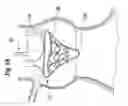Fig. 04 - Prosthetic heart valve deployment systems