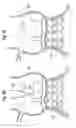 Fig. 06 - Prosthetic heart valve deployment systems
