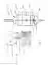 Fig. 02 - BALLOON CATHETER FOR PROSTHETIC VALVES