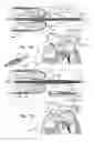 Fig. 02 - Minimally-invasive delivery systems
