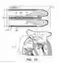 Fig. 03 - Minimally-invasive delivery systems