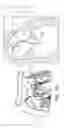 Fig. 04 - Minimally-invasive delivery systems