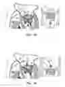 Fig. 05 - Minimally-invasive delivery systems