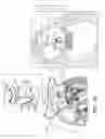 Fig. 16 - Minimally-invasive delivery systems