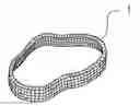 Fig. 01 - Aortic ring and ancillary device for implanting it