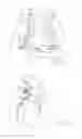 Fig. 04 - Aortic ring and ancillary device for implanting it