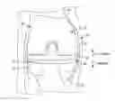 Fig. 01 - Components for artificial joints
