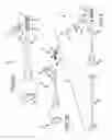 Fig. 03 - Methods of fusing a sacroiliac joint with an additively manufactured sacroiliac joint implant