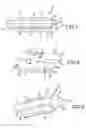 Fig. 05 - Methods of fusing a sacroiliac joint with an additively manufactured sacroiliac joint implant